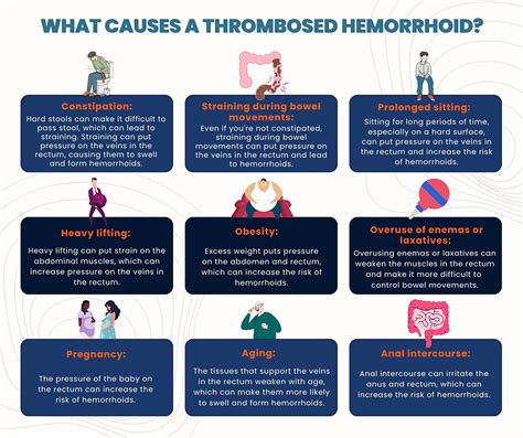 Thrombosed Hemorrhoid Ligation at John Koger blog