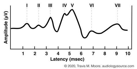 Auditory Brainstem Response (ABR)