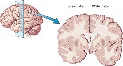 Reading and White Matter in the Brain - Keys to Literacy