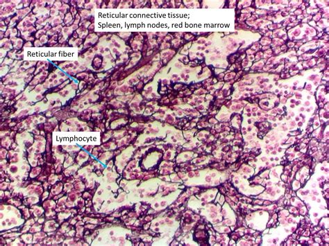 Reticular Connective Tissue Slides Labeled