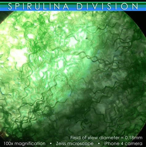 100x magnification of spirulina platensis organisms. | Spirulina ...