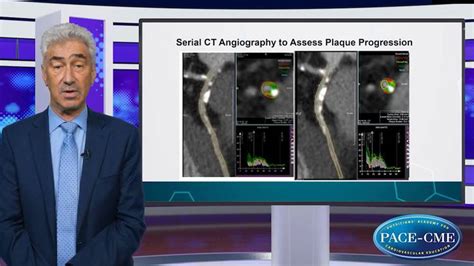 CME: Mechanistic clues to understanding the benefits of icosapent ethyl - PACE-CME