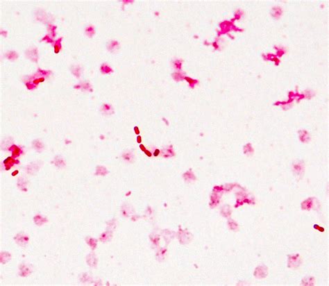 Klebsiella Pneumoniae Gram Stain Morphology