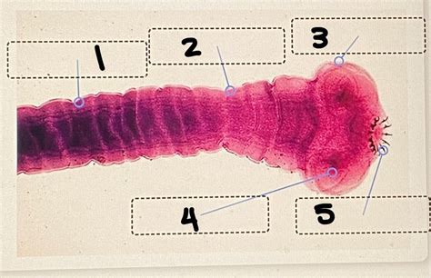 tapeworm anatomy Diagram | Quizlet