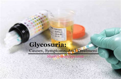 Glycosuria: Causes, Symptoms, Treatment And Diabetes