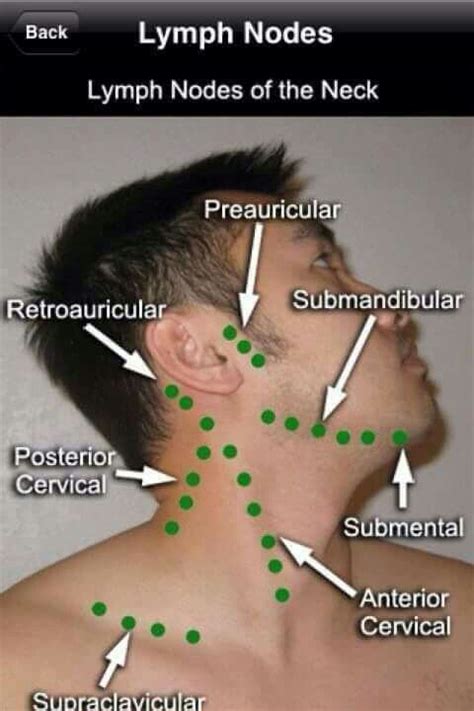 Lymph Nodes of the neck | Medical knowledge, Medical education, Medical