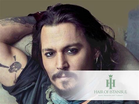 Johnny Depp Hair Transplant: Is it Gossip?