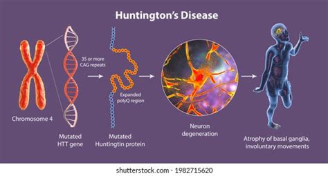 Hereditary disease 1,751 รายการ ภาพ ภาพสต็อกและเวกเตอร์ | Shutterstock