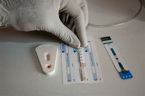 A Simple Guide on Using Home HIV Test Kits – Tests to Diagnose HIV