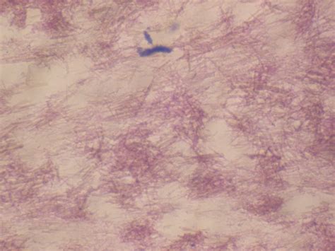 Monosodium urate crystals on light microscopy. | Download Scientific Diagram