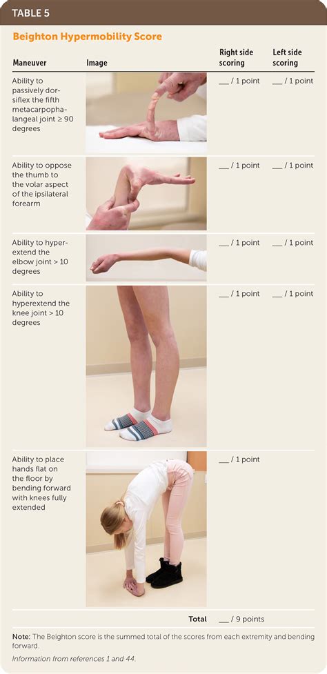 Hypermobile Ehlers-Danlos Syndrome and Hypermobility Spectrum Disorders ...