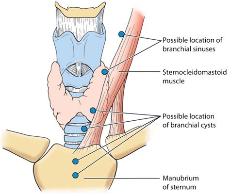 Branchial Cleft Malformations, Pediatric | Diseases & Conditions ...