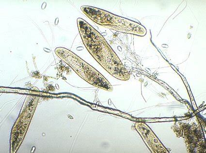 MICROSCOPY UK / MICSCAPE - protozoa, collection and study