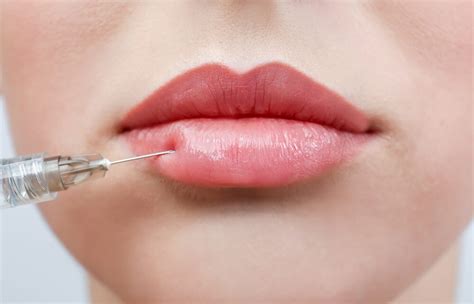 Comparing Different Dermal Fillers | National Laser Institute Medical Spa