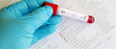 Detection of autoantibodies and inflammatory markers