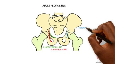 Radiographic features - Adult pelvic lines - YouTube