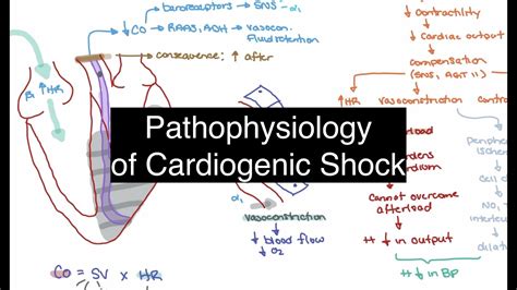 Pathophysiology of Cardiogenic Shock - YouTube