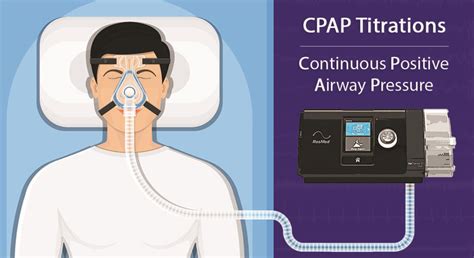 CPAP Titrations - Durbanville Sleep Lab