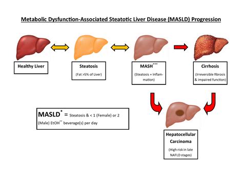 The Lasting Effects of COVID-19 on the Progression of Metabolic Dysfunction-Associated Steatotic ...