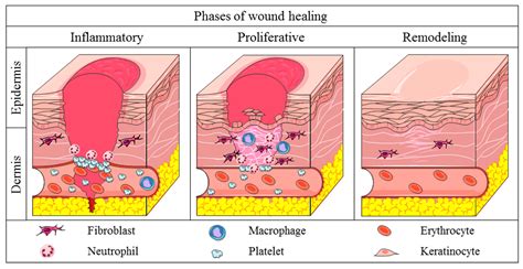 Life | Free Full-Text | Cutaneous Wound Healing: An Update from ...