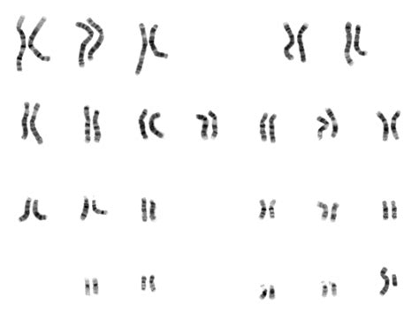 Karyotyping- Definition, Principle, Preparation and Technical Procedure ...