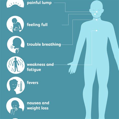 Castleman Disease: Symptoms, Causes, and Treatment