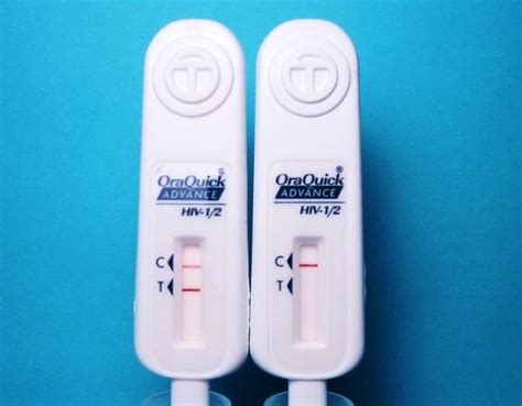 HIV antibody and antigen testing - HIV Management Guidelines