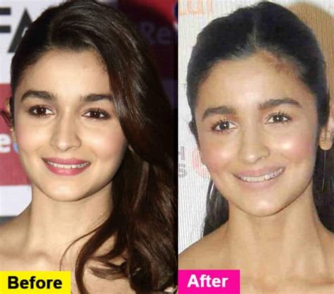 Is Alia Bhatt looking different? - Bollywoodlife.com