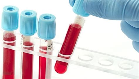 Synthetic Blood Buys Patients More Time | Healthcare Packaging