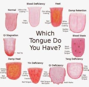 Tongue: Why do acupuncturists look at my tongue? | Wellpoint Acupuncture | Finchley, North London