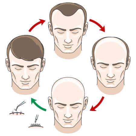 The Mechanism Of Hair Growth Cycle - Shiftkiya.com