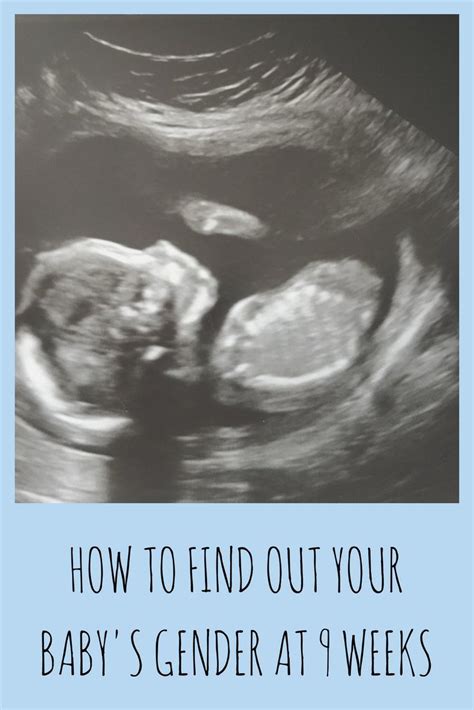 How to find out your baby's gender at 9 weeks | Baby gender ultrasound ...