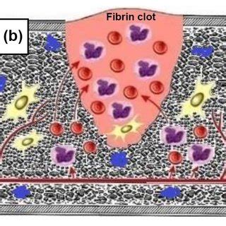 SkQ1 promotes granulation tissue formation and epithelization of old... | Download Scientific ...