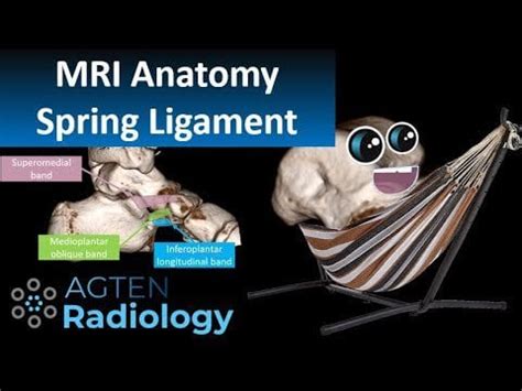 Spring Ligament Complex MRI Anatomy - easy way to find the ligaments ...