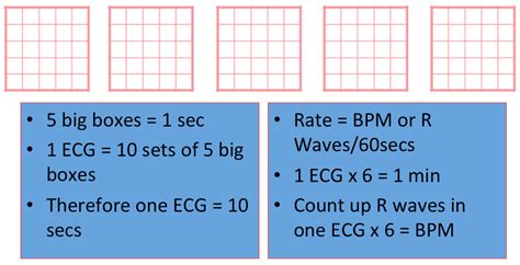 ECG Basics - REBEL EM - Emergency Medicine Blog