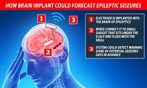 Epilepsy Warning Signs Of A Seizure / The Epilepsies And Seizures Hope Through Research National ...