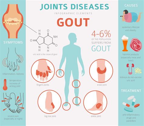 Gout — FOOT & ANKLE CENTERS