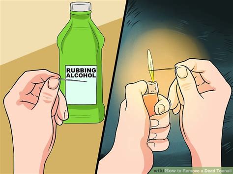 How to Remove a Dead Toenail (with Pictures) - wikiHow