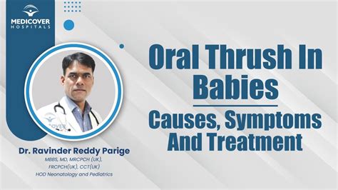 Oral Thrush In Babies: Causes, Symptoms And Treatment | Medicover ...