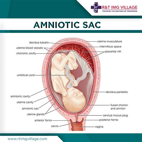 Amniotic Sac Diagram