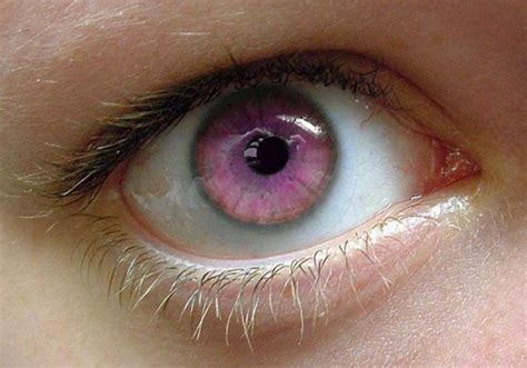 7 Rarest And Unusual Eye Colors That Looks Unreal