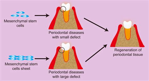 Stem cell‐based tooth and periodontal regeneration - Hu - 2018 - Oral Diseases - Wiley Online ...