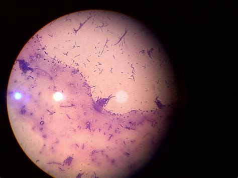 Bacillus subtilis (sederhana)