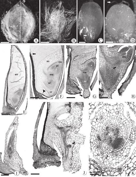 Morphology and anatomy of the diaspore, caryopsis and initial seedling... | Download Scientific ...