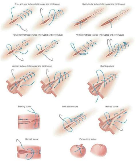 Sutures … | Veterinary Technician | Survi…