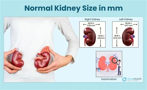 What is Normal Kidney Size in mm? - Left and Right Side