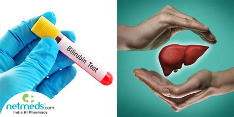 Bilirubin Test: Why It Is Done And What To Expect