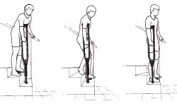 Physiotherapy: How to use crutches