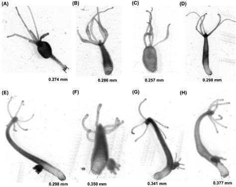 Hydra Under Microscope