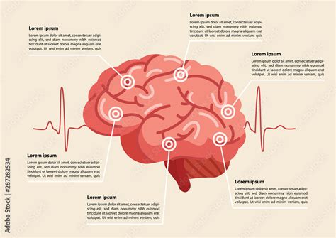 Human brain stroke illustration. Stock Vector | Adobe Stock